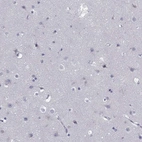 Immunohistochemical staining of human cerebral cortex shows low expression as expected.