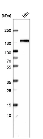 Western blot analysis in human cell line HEL.