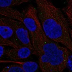 Anti-GSDMC Antibody