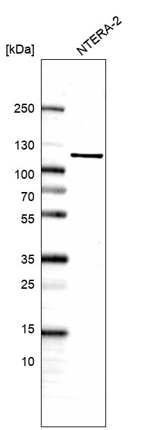 Anti-JADE1 Antibody