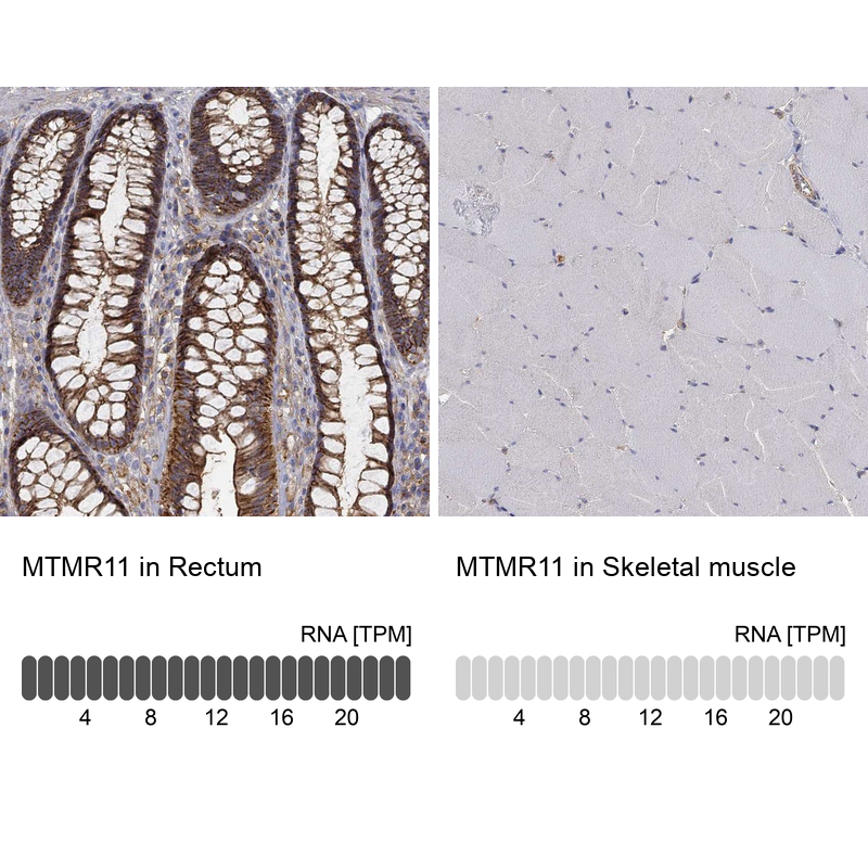 Anti-MTMR11 Antibody