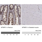 Anti-MTMR11 Antibody