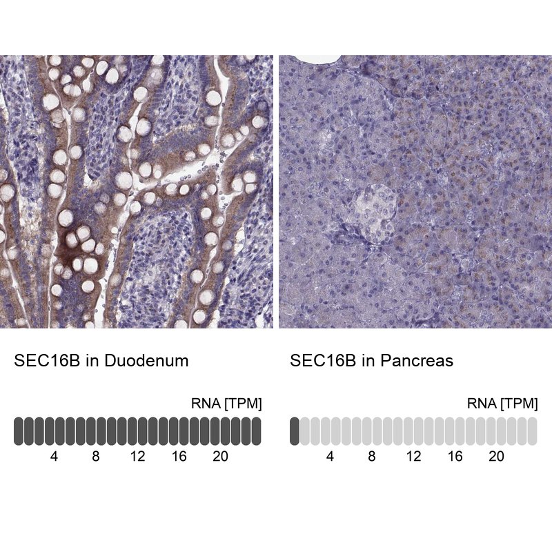 Anti-SEC16B Antibody