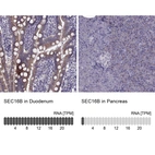Anti-SEC16B Antibody
