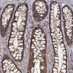Immunohistochemical staining of human rectum shows high expression.