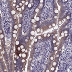 Immunohistochemical staining of human duodenum shows high expression.