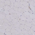 Immunohistochemical staining of human skeletal muscle shows low expression as expected.