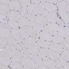 Immunohistochemical staining of human skeletal muscle shows low expression as expected.