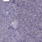 Anti-SEC16B Antibody