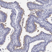 Anti-ERICH3 Antibody