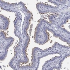 Anti-ERICH3 Antibody