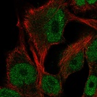 Anti-ITPKB Antibody