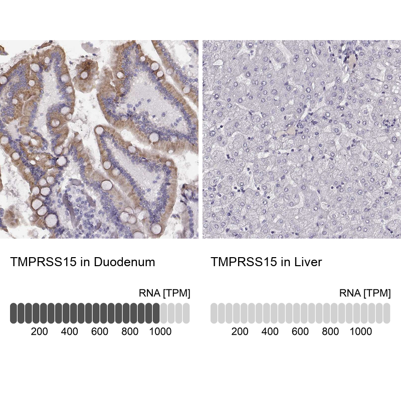 Anti-TMPRSS15 Antibody