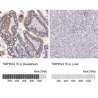 Anti-TMPRSS15 Antibody