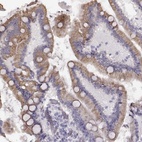 Anti-TMPRSS15 Antibody