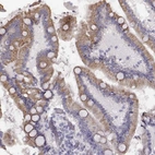 Immunohistochemical staining of human duodenum shows high expression.