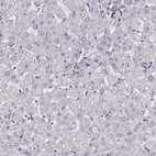 Immunohistochemical staining of human liver shows low expression as expected.