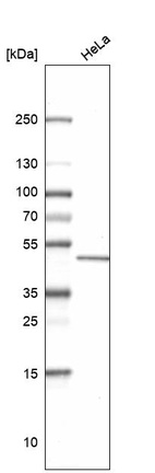 Anti-ETNPPL Antibody