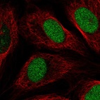 Immunofluorescent staining of human cell line U-2 OS shows localization to nucleus.