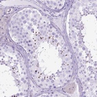 Immunohistochemical staining of human testis shows high expression.