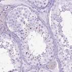 Immunohistochemical staining of human testis shows high expression.
