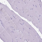 Immunohistochemical staining of human skeletal muscle shows low expression as expected.