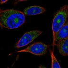 Immunofluorescent staining of human cell line PC-3 shows localization to nucleoli & mitochondria.