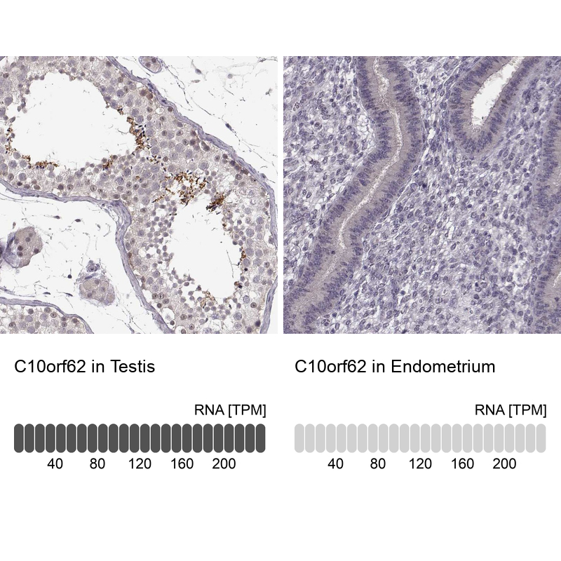Anti-C10orf62 Antibody