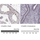 Anti-C10orf62 Antibody