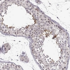 Immunohistochemical staining of human testis shows high expression.
