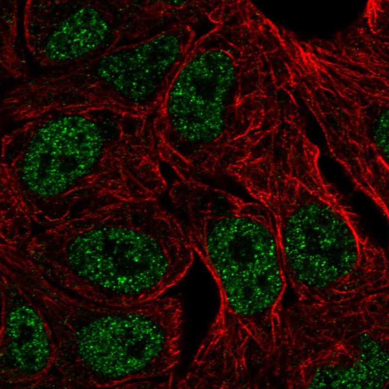 Anti-ZNF283 Antibody