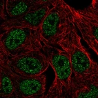 Anti-ZNF283 Antibody