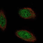 Anti-TMEM267 Antibody