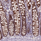 Anti-ARL1 Antibody