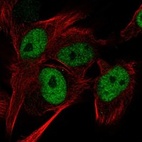 Immunofluorescent staining of human cell line U-251 MG shows localization to nucleoplasm.