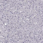 Immunohistochemical staining of human liver shows no positivity in hepatocytes as expected.