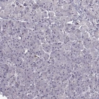 Immunohistochemical staining of human pancreas shows no positivity in exocrine glandular cells as expected.