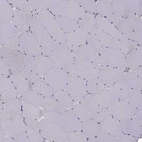 Immunohistochemical staining of human skeletal muscle shows no positivity in myocytes as expected.
