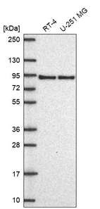 Western blot analysis in human cell line RT-4 and human cell line U-251 MG.