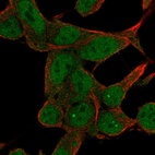 Anti-ZNF829 Antibody