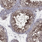 Anti-MEA1 Antibody