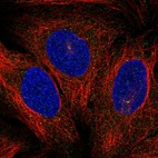 Anti-PRKCQ Antibody