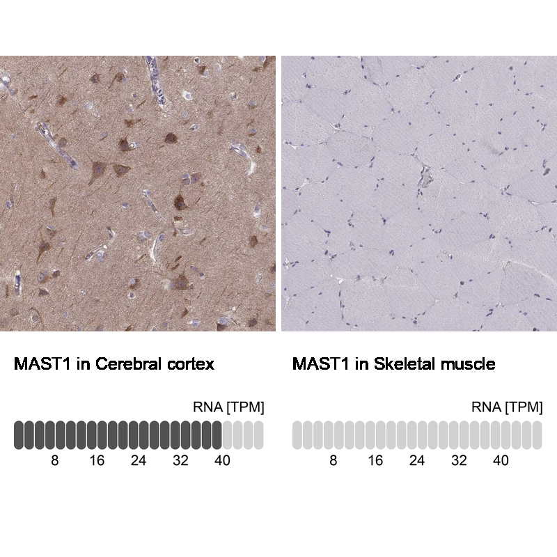 Anti-MAST1 Antibody
