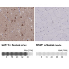 Anti-MAST1 Antibody