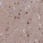 Immunohistochemical staining of human cerebral cortex shows moderate cytoplasmic positivity in neurons and neuropil.