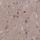 Immunohistochemical staining of human cerebral cortex shows moderate cytoplasmic positivity in neurons and neuropil.