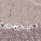 Immunohistochemical staining of human cerebellum shows moderate cytoplasmic positivity in Purkinje cells.