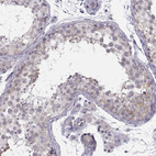 Immunohistochemical staining of human testis shows weak cytoplasmic positivity in cells in seminiferous ducts.