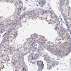 Immunohistochemical staining of human testis shows weak cytoplasmic positivity in cells in seminiferous ducts.