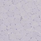 Immunohistochemical staining of human skeletal muscle shows no cytoplasmic positivity in myocytes as expected.
